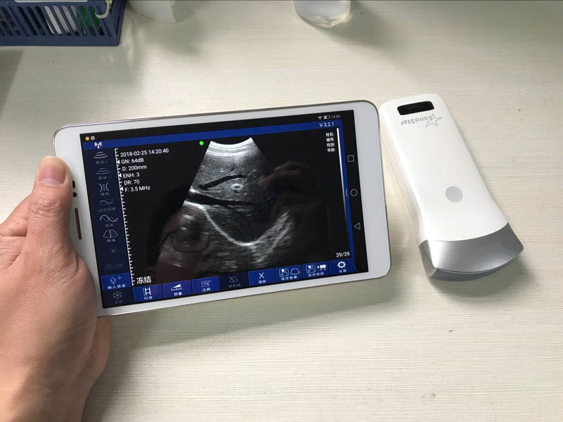 Wireless Ultrasound Probe WIFI Probe Convex / Linear Support ISO Andriod Portable Wifi-Scanner 3.5Mhz / 7.5Mhz