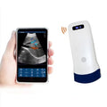 Wireless Ultrasound Probe WIFI Probe Convex / Linear Support ISO Andriod Portable Wifi-Scanner 3.5Mhz / 7.5Mhz