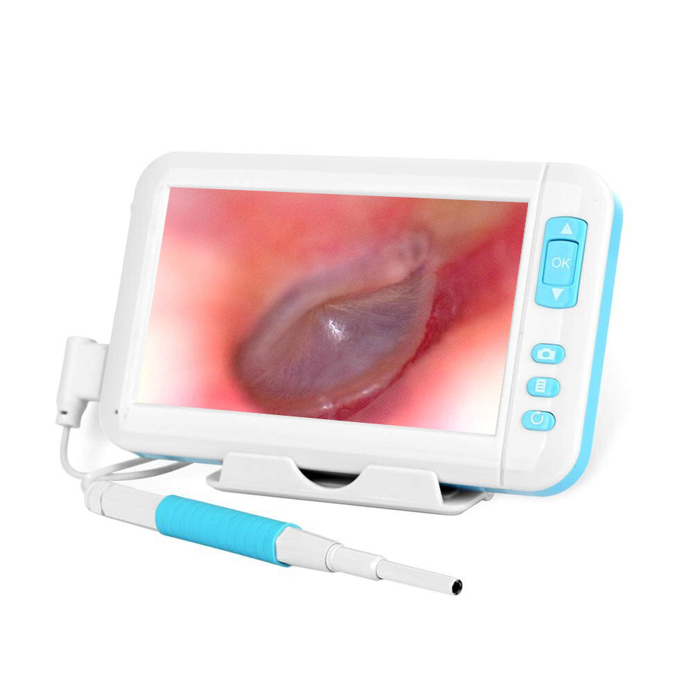 Caméra d'otoscope vidéo 3.9MM 1080p oreille inspecter caméra de cérumen  outil de nettoyage d'endoscope médical numérique écran de 4,3 pouces  écran HD