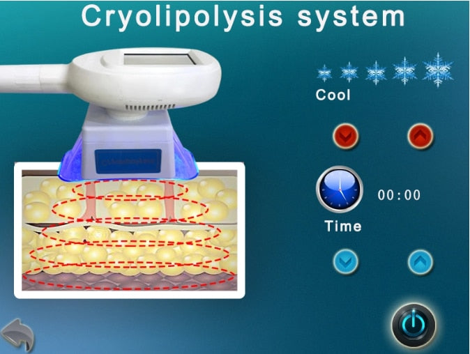 Principle of cryolipolysis machine