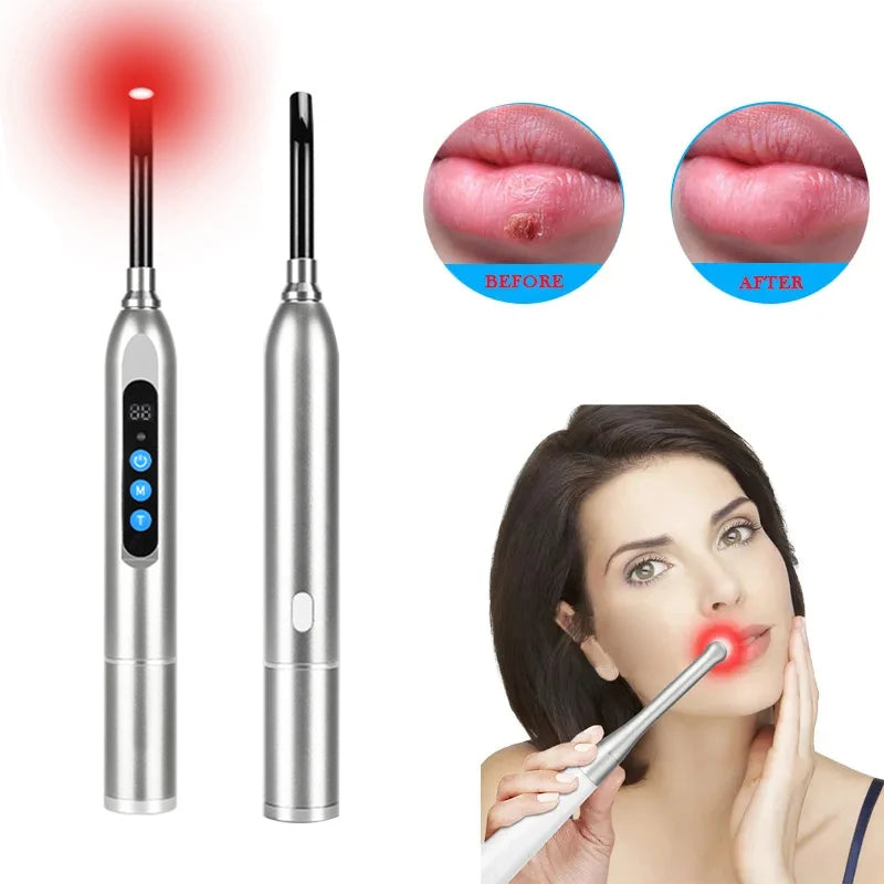 Red Light Therapy Device Wireless Led Near Infrared Cold Sore And Canker Sore Light Therapy