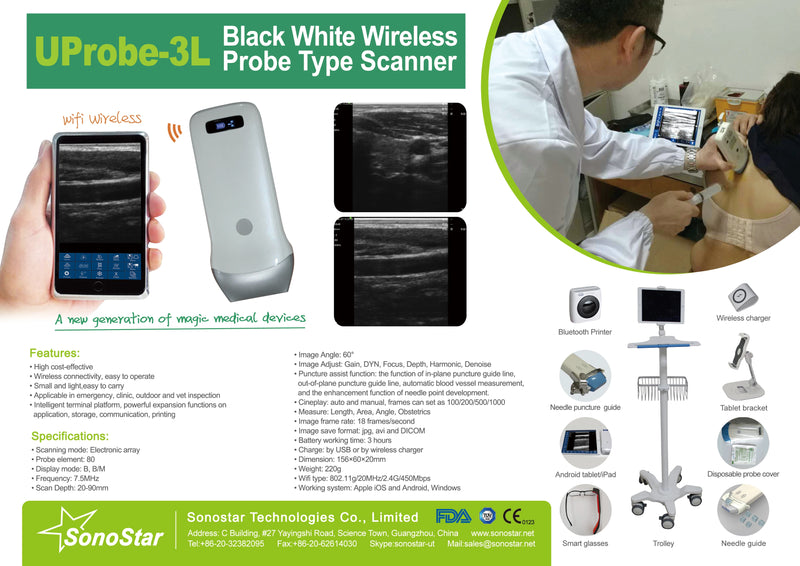 Wireless Ultrasound Probe