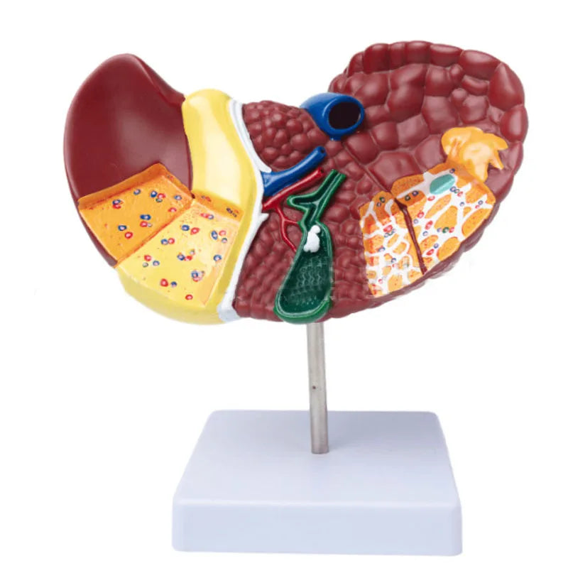 1:1 Människopatologisk lever Anatomisk modell Visning av matsmältningssystemet Anatomi undervisningsmodell