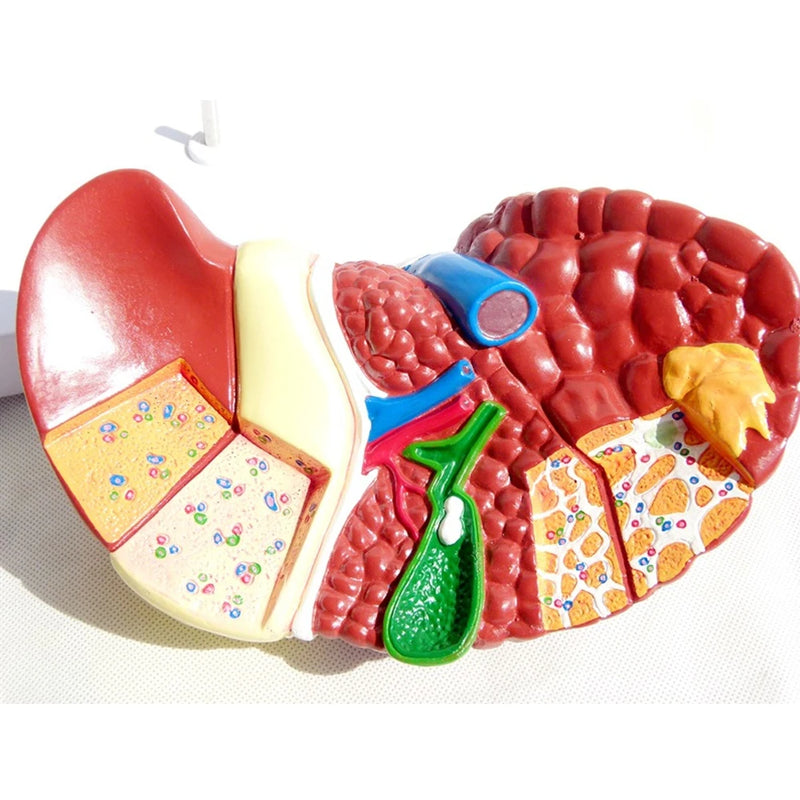 1:1 Människopatologisk lever Anatomisk modell Visning av matsmältningssystemet Anatomi undervisningsmodell