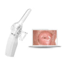 Mini Colposcope dengan Video Digital untuk Pemantauan Kesihatan yang Tepat dan Mudah Aksesori Ujian Kendiri Monitor Pilihan