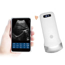 Wireless Ultrasound Probe
