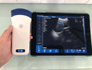 Vezeték nélküli ultrahang szonda WIFI szonda CProbe-5C színes Doppler128E konvex támogatás ISO Andriod hordozható Wifi-szkenner 3,2Mhz / 5Mhz