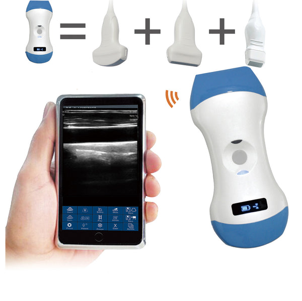 Scanner per ultrasuoni con sonda a ultrasuoni wireless 3 in 1 con supporto WIFI per scansione iOS, Android, convessa, lineare e a fasi