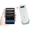 Wireless Ultrasound Probe