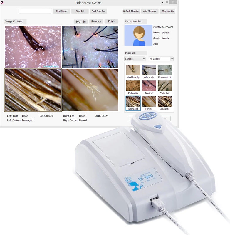 Professional Hair and Scalp Analysis Device Hair Analyzer Machine With Member Management Storage