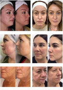 المحمولة 2 في 1 Morpheus8 آلة رفع الجلد مكافحة الشيخوخة النمش إزالة التجاعيد علاج حب الشباب كسور صالون استخدام جهاز