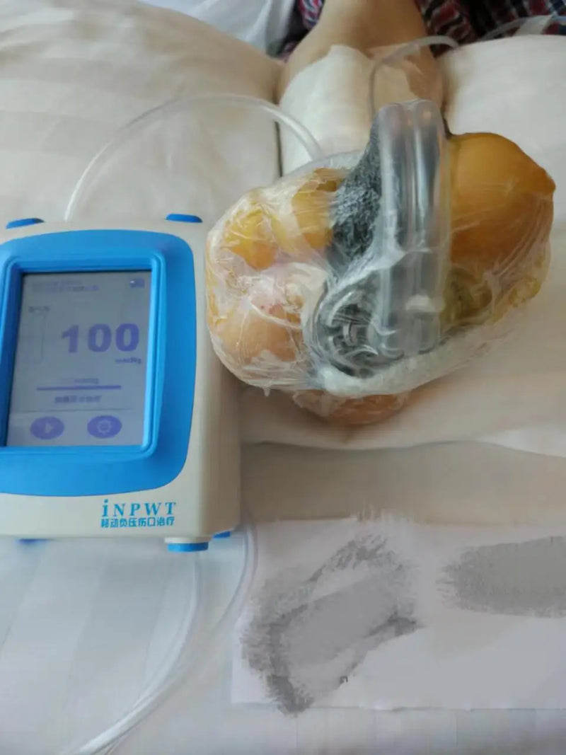 dressing vacuum INPWT-S1 Negative Pressure Wound Therapy System Devices Wound Vac Machine And Npwt Dressing Kits