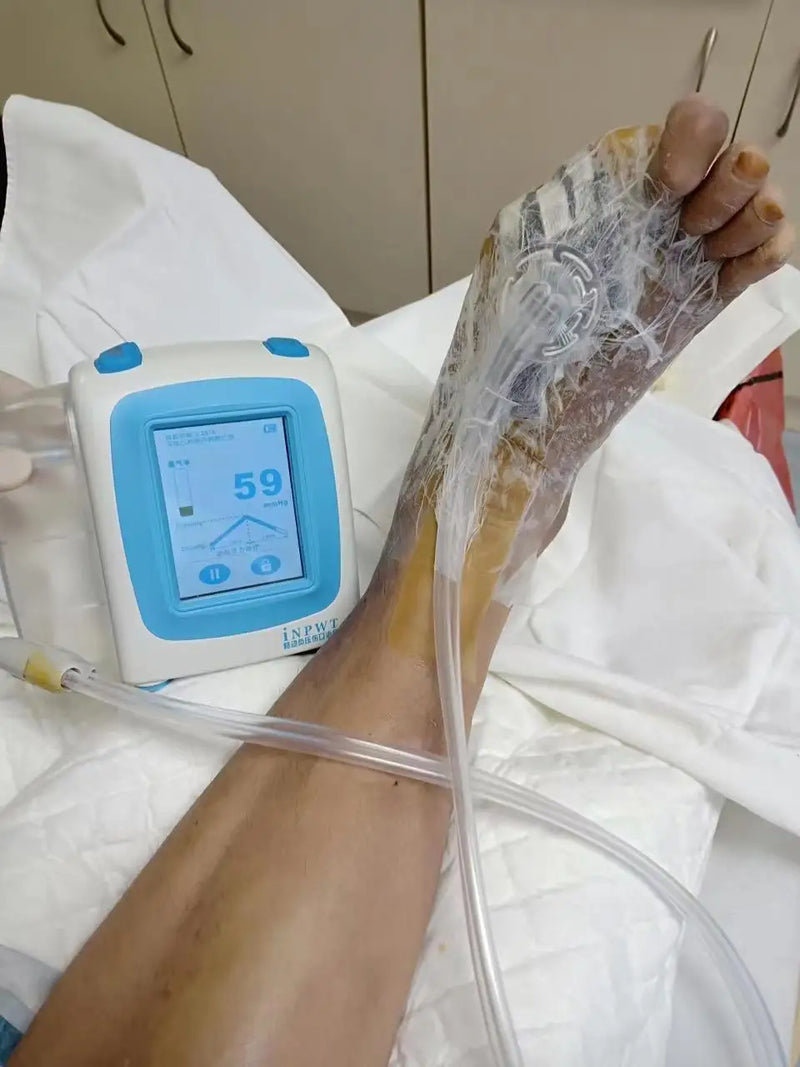 INPWT-S1 Negative Pressure Wound Therapy System Devices Wound Vac ...
