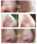 3 em 1 Limpeza Profunda do Rosto Aquasure H2 Dispositivo H2o2 Água Oxigênio Peeling Dermoabrasão Máquina de Limpeza