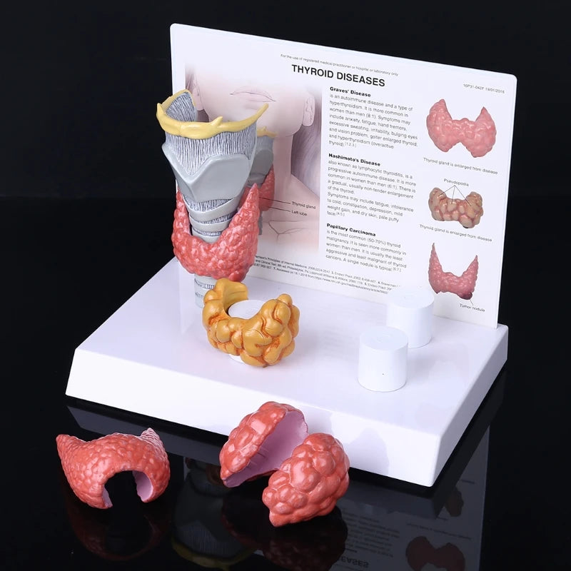 Modelo anatômico humano da glândula tireóide, patologia, sistema digestivo, exibição, ferramenta de ensino, dia das bruxas