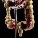Human Colorectal Lesion Model Pathological Anatomy Colon Diseases Intestine Medical Teaching Learning Tool