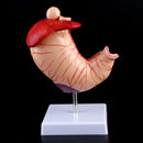 Anatomie humaine, modèle médical de l'estomac, pathologie gastrique, gastrite, ulcère, enseignement médical, outil d'apprentissage
