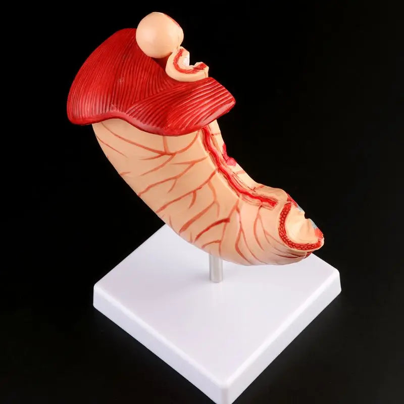 Anatomia anatomica umana Stomaco Modello medico Patologia gastrica Gastrite Ulcera Strumento di apprendimento per l'insegnamento medico