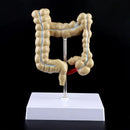 Human Colorectal Lesion Model Pathological Anatomy Colon Diseases Intestine Medical Teaching Learning Tool