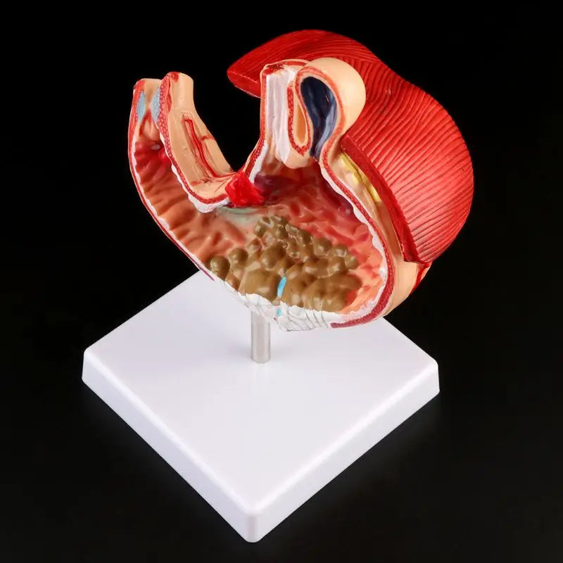 Anatomia człowieka Model medyczny żołądka Patologia żołądka Zapalenie żołądka Wrzód Medyczne narzędzie do nauczania
