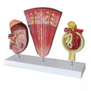 Human Kidney Anatomy Model Nephron Model Glomerular Model Urinary System Model Medical Demonstration Aid
