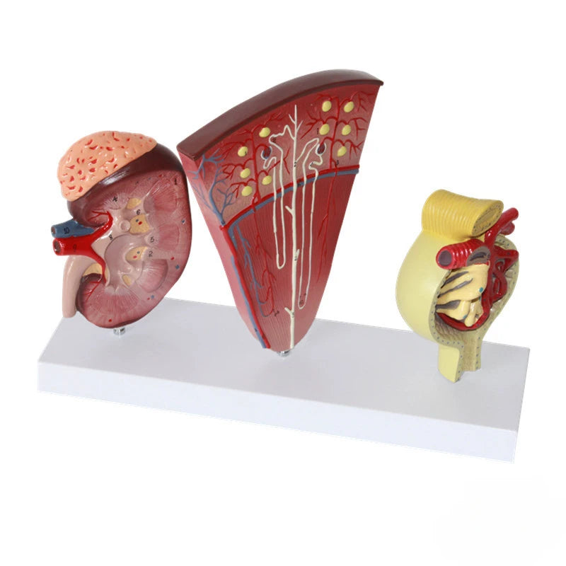 Modelo de anatomia do rim humano Modelo de néfron Modelo glomerular Modelo do sistema urinário Auxílio para demonstração médica