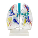 2 Times Transparent Human Lung Anatomy Thoracic Surgery Bronchial Tree Model Medical Model Supplies