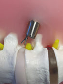 Discectomie endoscopique transforaminale percutanée, modèle d'entraînement Pted, modèle de dos humain, doux et perforable