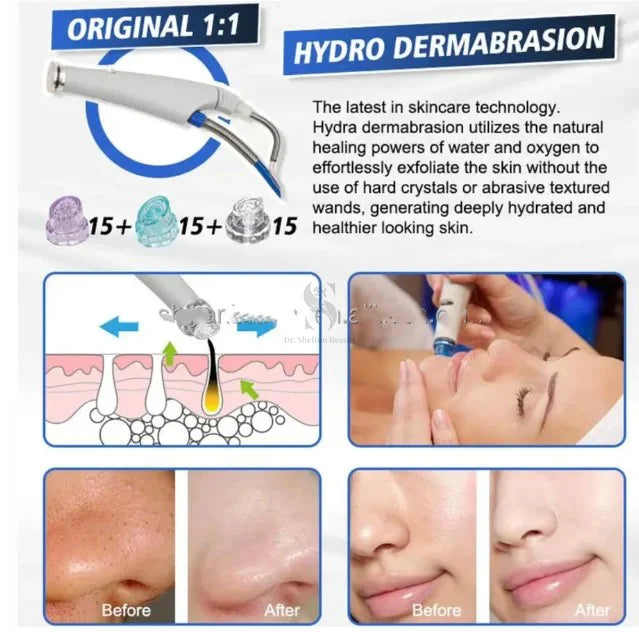 Bejgħ oriġinali H2O2 Tindif fil-fond Aqua Peel Facial għal Bio Micro Oxygenation Facial Face Lifting Diamond Dermo Brassion