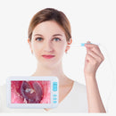 3,9 mm Video Otoscope Camera 1080p Ear Inspect Earwax Camera Digitalt endoskop rengöringsverktyg 4,3 tums skärm HD-skärm