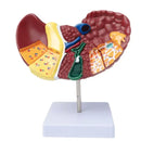 Pathological Liver Anatomical Model 1:1 Human Liver Model Anatomy Display for Medical School Study and Research