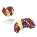 Pathological Liver Anatomical Model 1:1 Human Liver Model Anatomy Display for Medical School Study and Research
