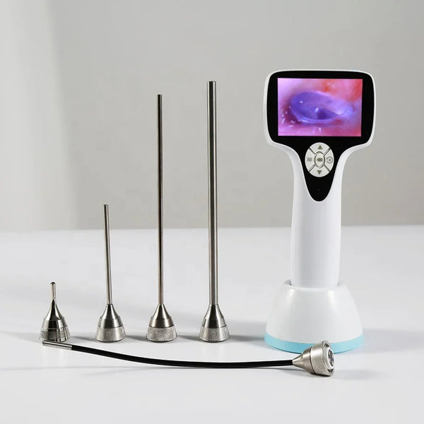 Draadloze medische endoscoop Video digitale otoscoopset met camera voor oorotoscoop De Diagnostic
