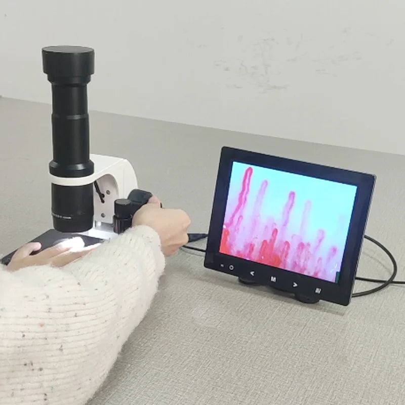 Professional Capillaroscope 9 Inch Monitor Nailfold Capillaroscopy ...