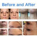 プロフェッショナルフェイシャル電気刺激EMRFフェイスEMS RFフェイスリフティングマシンPEFACEスカルプトフェイスパッドマッサージデバイス