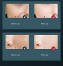 UV lamp nano spray facial blue photon beauty color lights therapy device red led facial light therapy machine