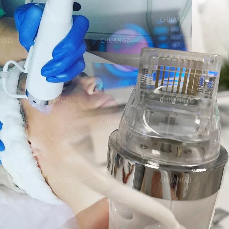 Młotek lodowy frakcyjna maszyna do mikroigieł RF usuwanie rozstępów sprzęt kosmetyczny dokręcić maszynę do mikroigieł