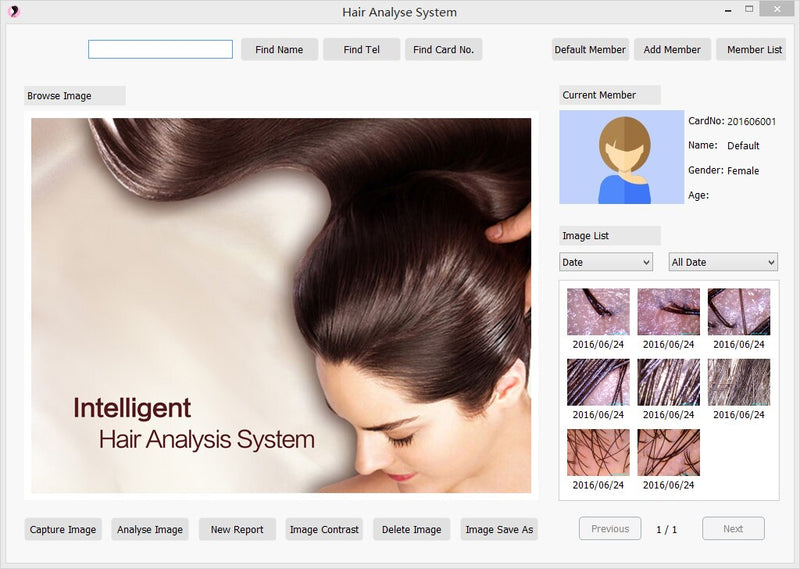 Professional Hair and Scalp Analysis Device Hair Analyzer Machine With Member Management Storage