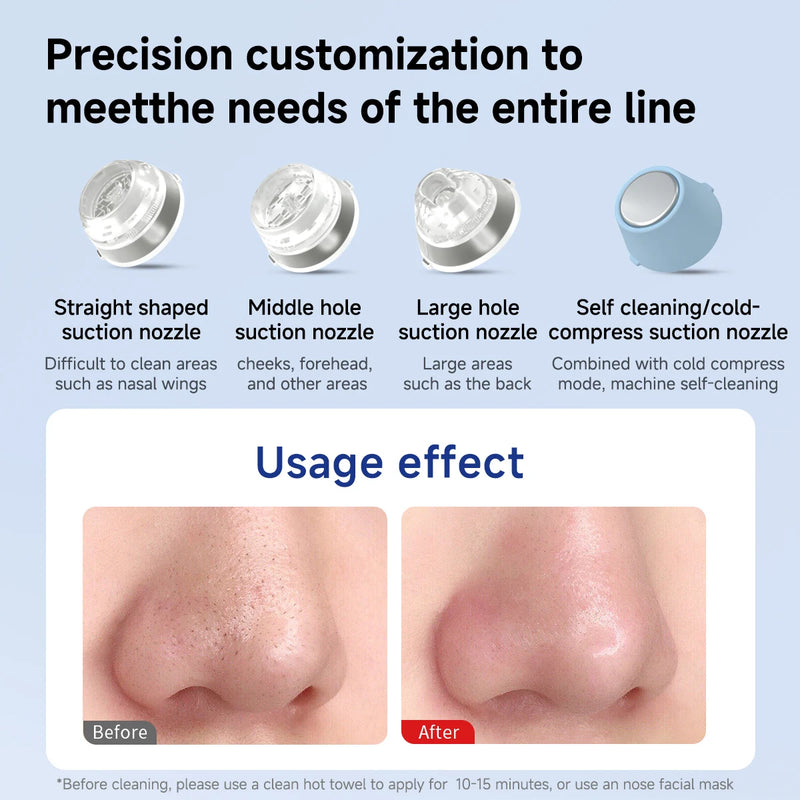 Compres Cleaner Cleansing|doco 2.0 Blackhead Remover - Hot & Cold Compress, Pore Vacuum ...