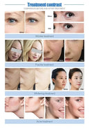 Зволожувальний спрей Jet Peel - неінвазивний зволожувальний кисневий пілінг для обличчя