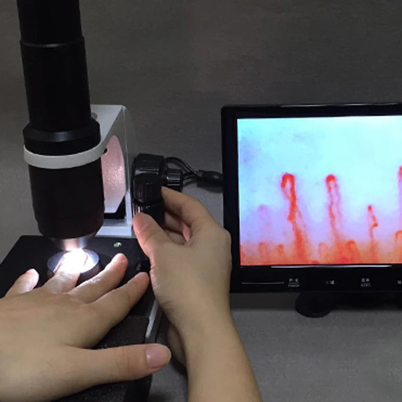 Professional Capillaroscope 9 Inch Monitor Nailfold Capillaroscopy ...