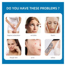 Mesin Perbaikan Bekas Luka Portabel Laser Fraksional CO2 Peremajaan Kulit Pelapisan Ulang Peralatan Penghilang Bekas Jerawat yang Efektif Mesin Pengencangan Vagina