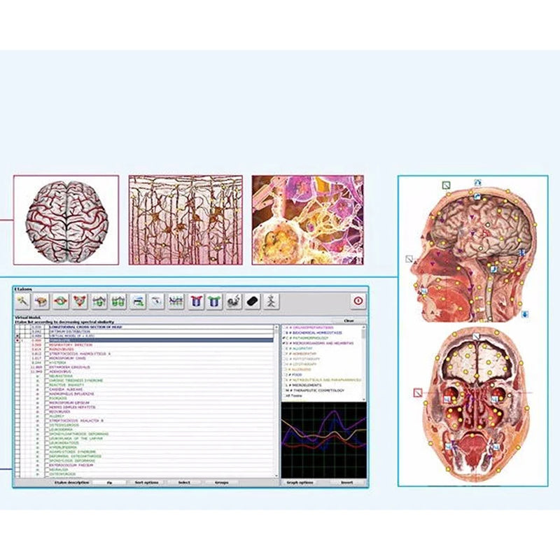 Suyzeko Viżwalizzazzjoni Metatron GR Hunter 4025 NLS Full Body Scanner Machine Metapathia GR Bioresonance Apparat analizzatur tas-saħħa