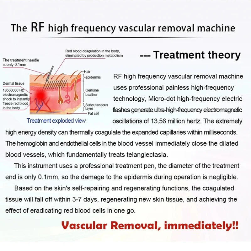 Machine Anti-rougeur pour l'élimination des veines d'araignée RF, aiguille à haute fréquence, vaisseau sanguin rouge et taches, dissolvant vasculaire, équipement de beauté