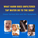 ALTHY ויטמין C מסנן מי מקלחת מחייה - מפחית כלור מתכת כבדה - משפר עור יבש ומגרד, קשקשים בשיער, אקזמה