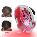 جهاز Lescolton D610 لنمو الشعر، خوذة نمو الشعر بالليزر، قبعة ضوء أحمر ليزر، قبعة علاج تساقط الشعر للرجال والنساء، لاسلكية