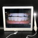 Cámara intraoral TV Cámara dental Equipo de dentista intraoral Intraoral de alta resolución con 8 LED