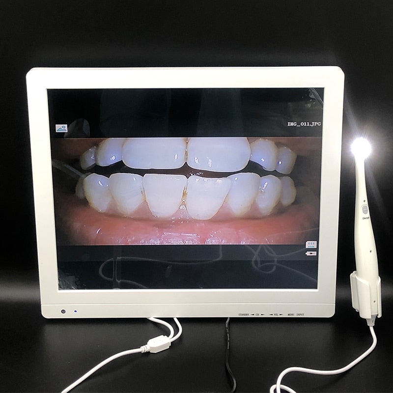 Kamera intraoral TV Kamera dentali Tagħmir tad-dentist intraoral Intraoral b'Riżoluzzjoni Għolja bi 8 LED