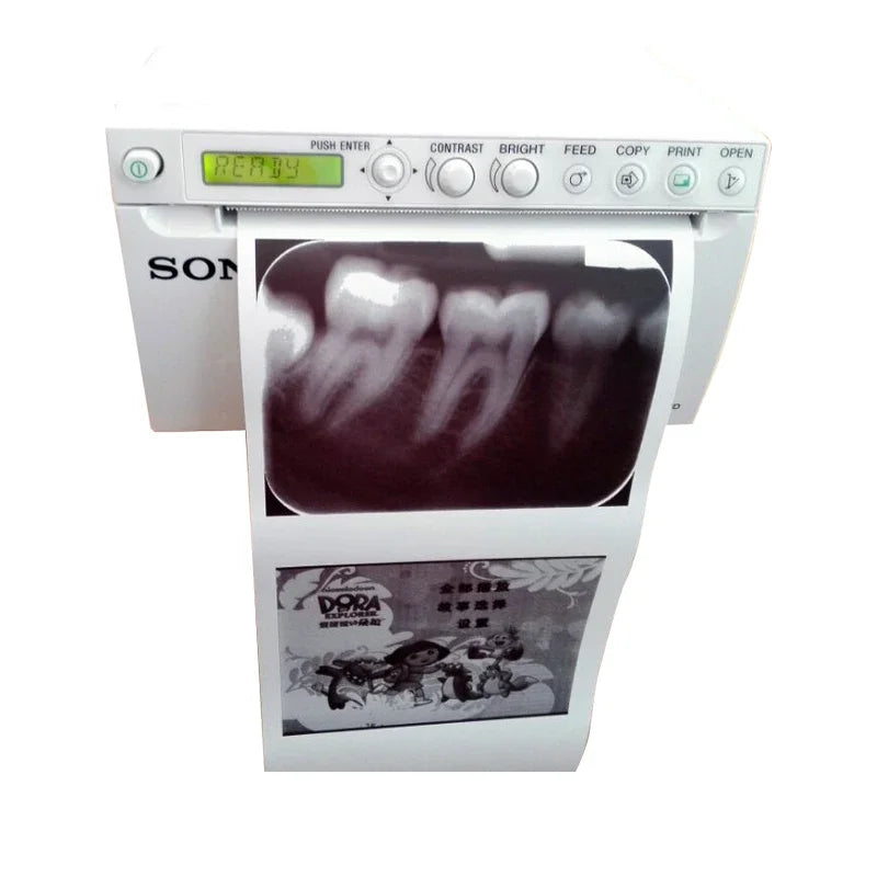 UP-X898MD Perubatan 3D 4D Doppler Ultrasound Harga Pencetak Video Pencetak Terma Mudah Alih Untuk Ultrasound Veterinar