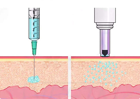 Electric Needle Free Injection System Needle Free Jet injector Gun